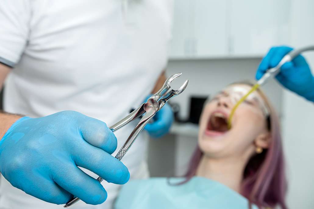 Impacted Tooth Removal