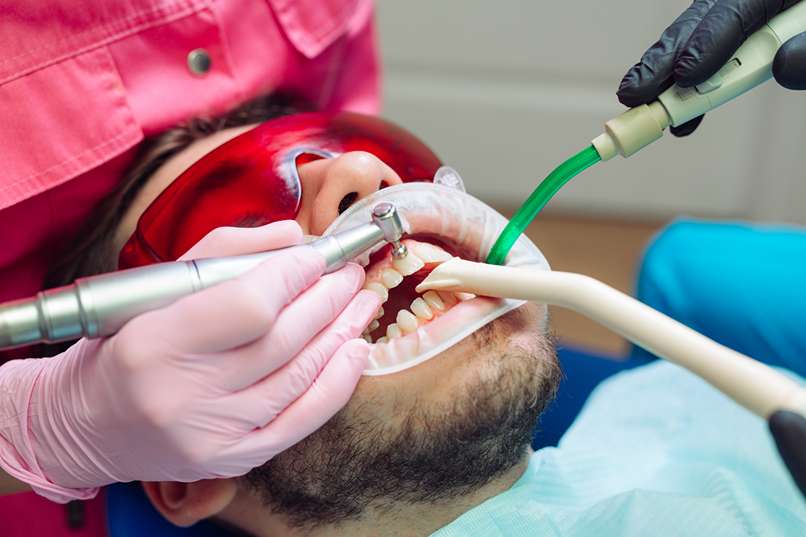 Teeth Scaling
