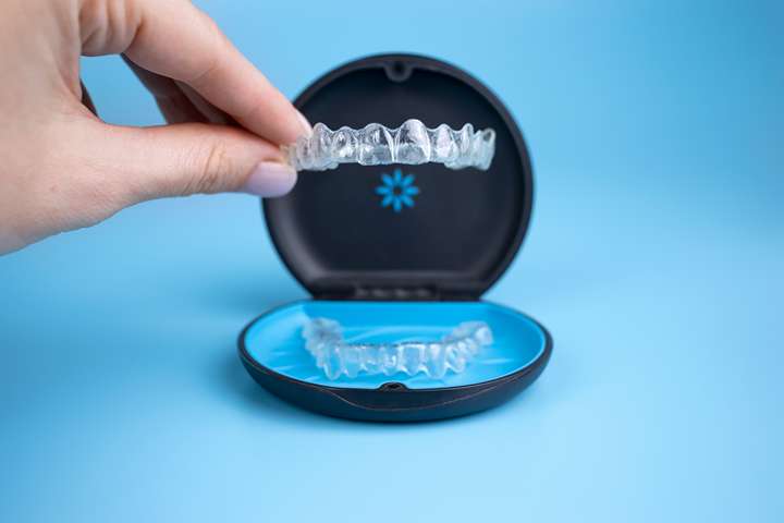 Invisalign Aligners