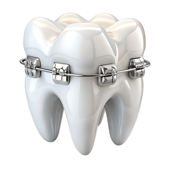 Single Teeth Braces Stracture