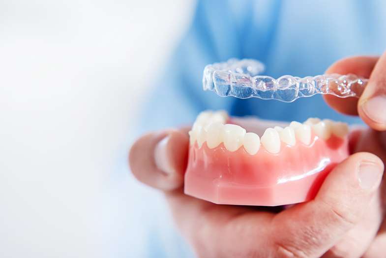 Invisalign Aligners