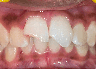 04-All-Treatment-85-111.png 04-All-Treatment-85-111.png
